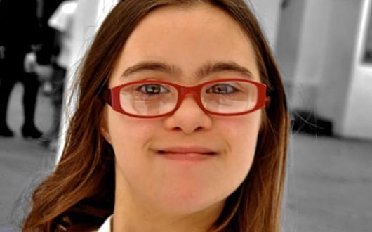 Lee más sobre el artículo Síndrome de Down en el dentista