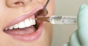 Lee más sobre el artículo Anestesia, una solución al Miedo al dentista