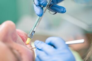 anestesia dental