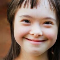 Pacientes con Síndrome de Down, clincia dental